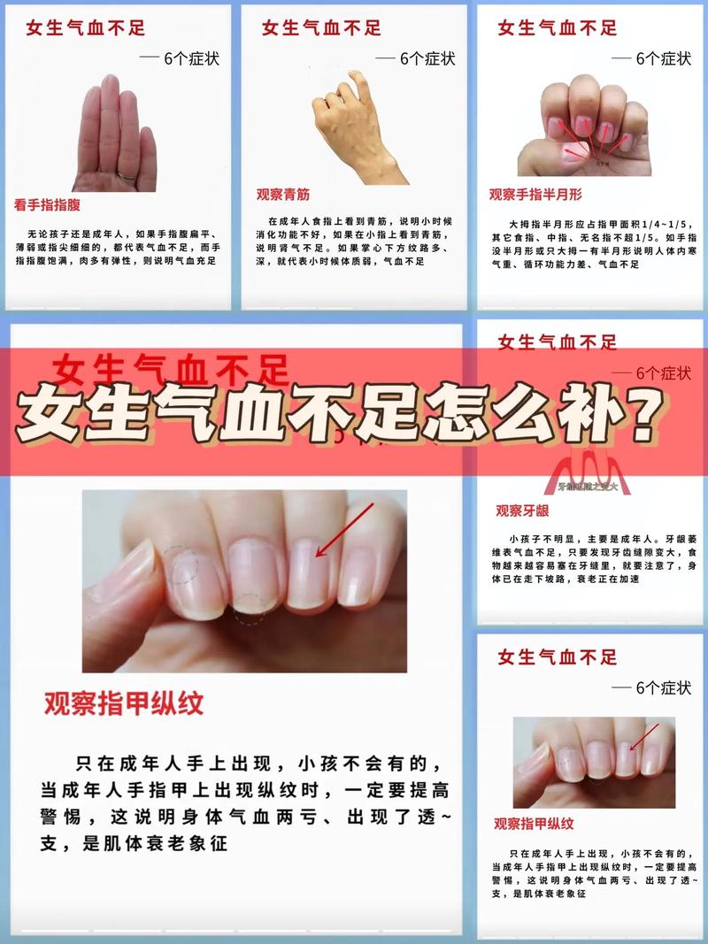 气血不足是怎么回事女生,气血不足的女生该如何调理